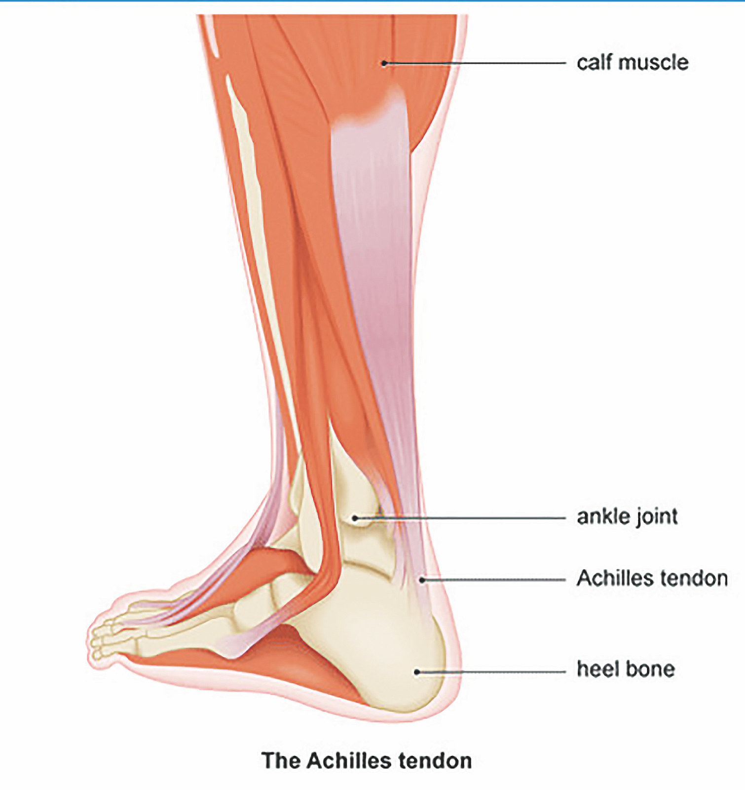 How To Beat Achilles Tendonitis – Sports Performance Physical Therapy