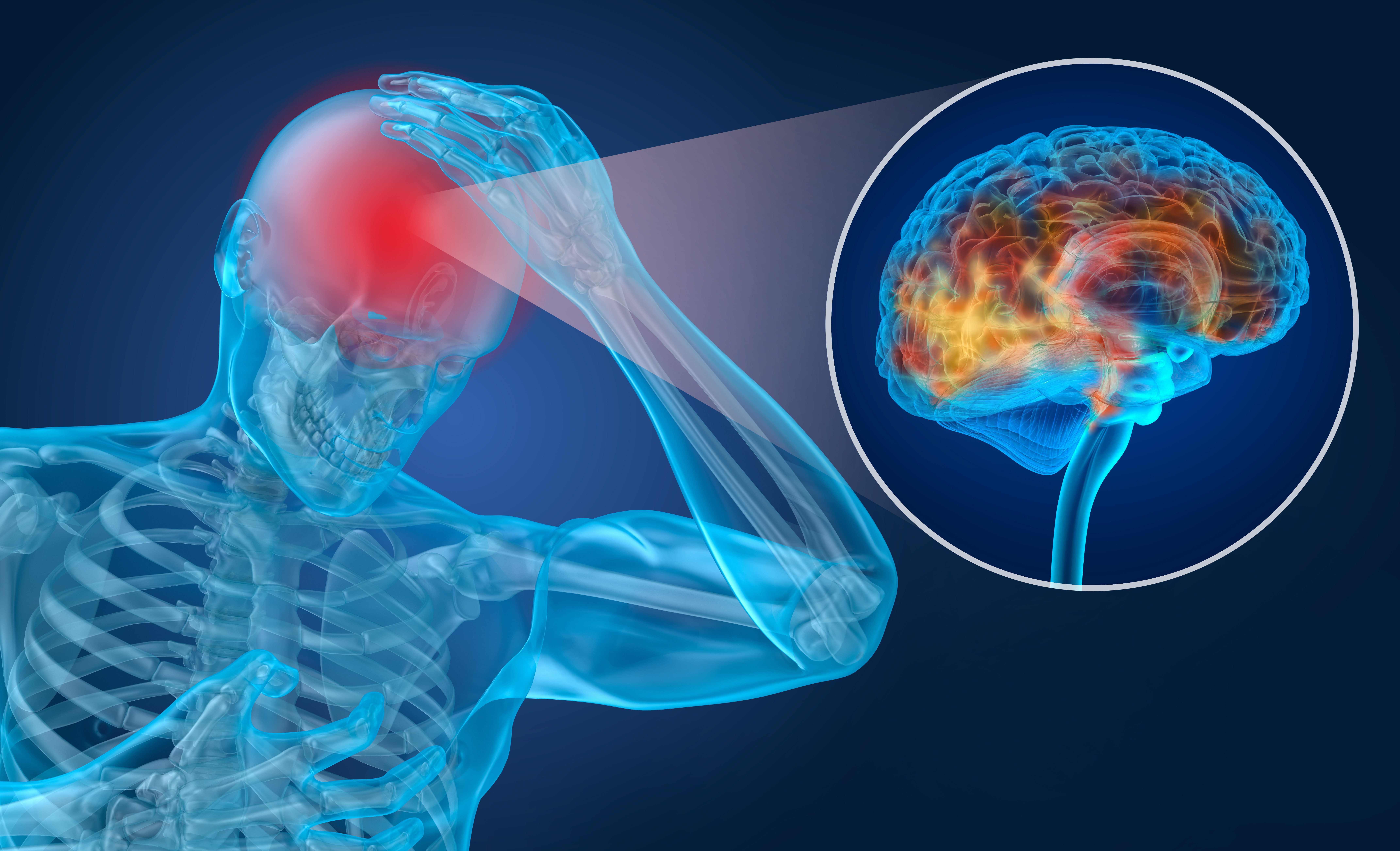 Physiotherapy for Concussion in Hockey