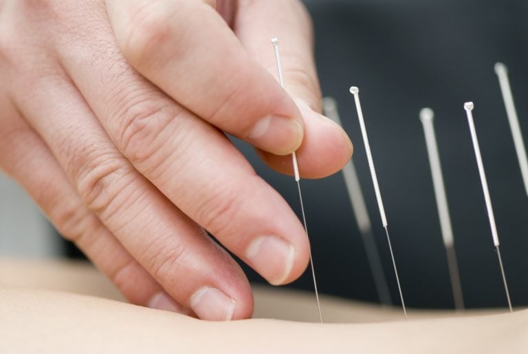 Dry Needling for IT Band Syndrome