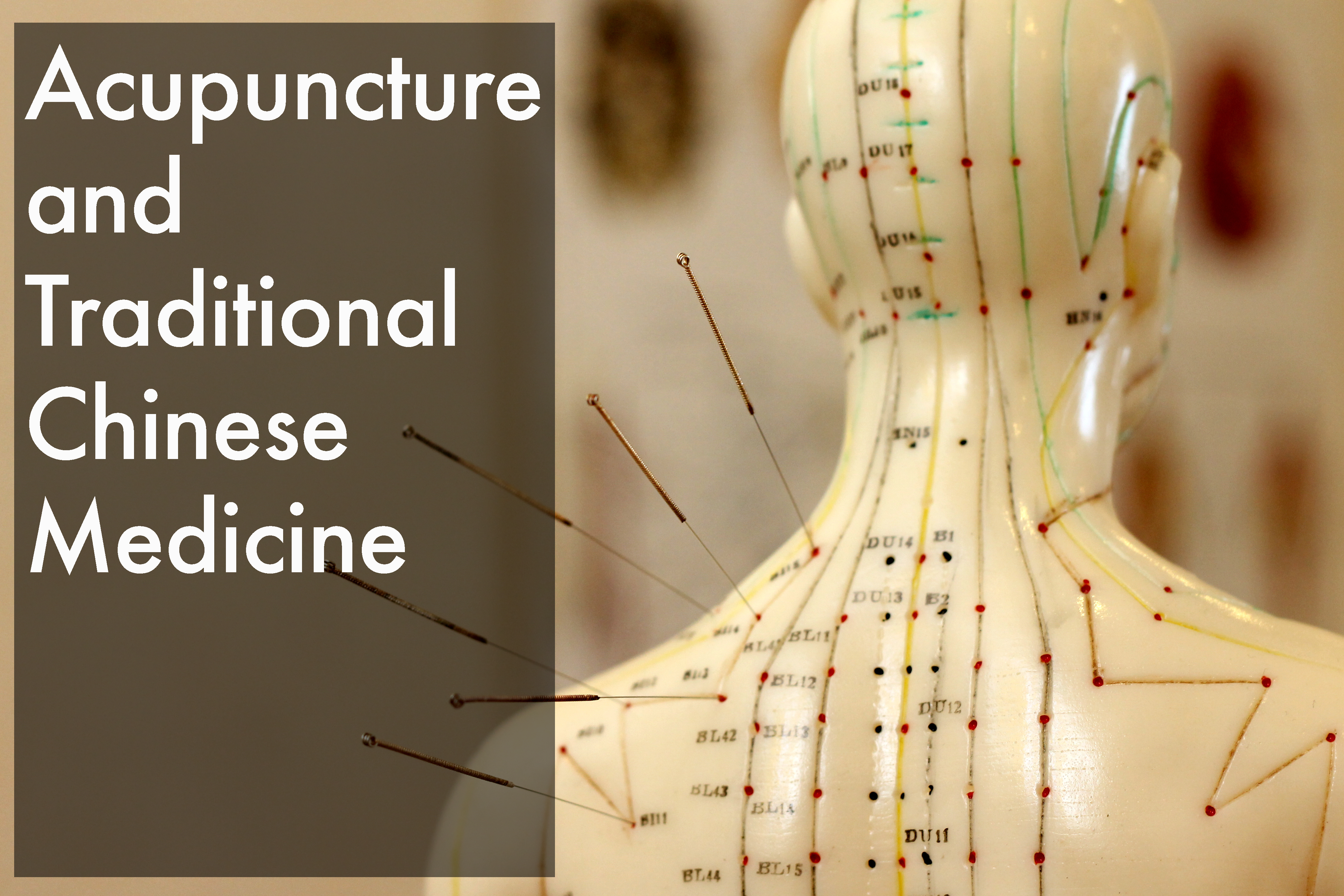 Similarities between Acupuncture and Traditional Chinese Medicine